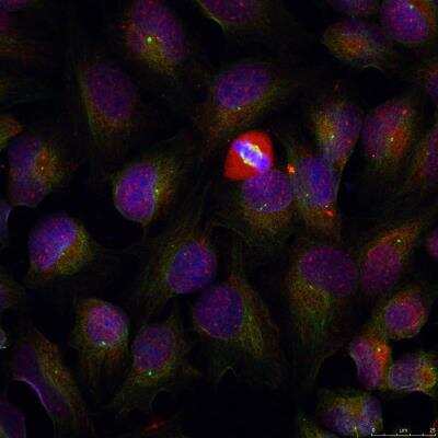 Immunocytochemistry/ Immunofluorescence: NFkB p105/p50 [p Ser337] Antibody [NB100-82074]